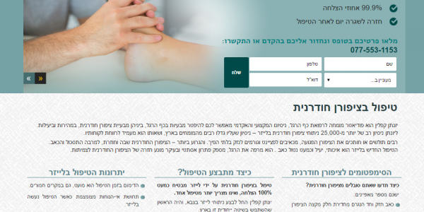 ביקורת מבנה: לייזר קפלין